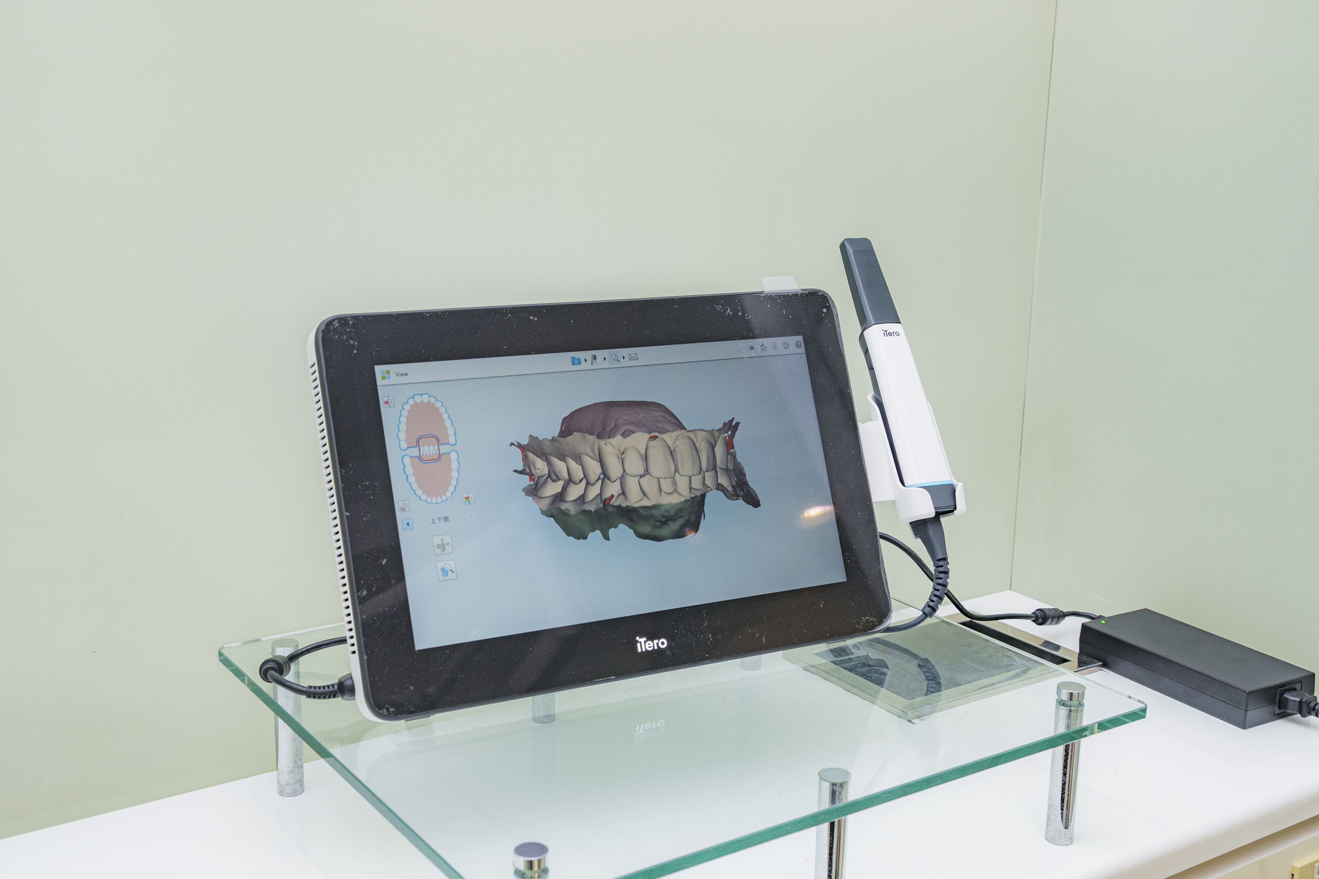 口腔内スキャナー